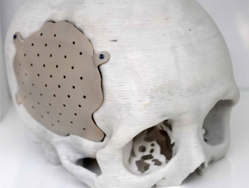 �@������ɫ�ĸ�ˎ��������Ŀ��������3D��ӡ���XĤ��